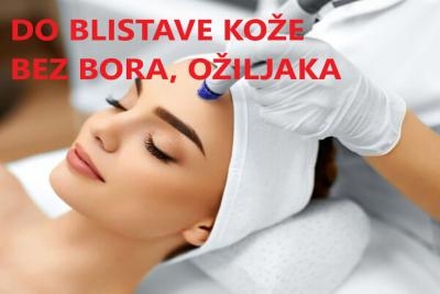 Tretman dermapenom regije po izboru, lice, vrat ili dekolte u centru za balans i lepotu Dr Petrović